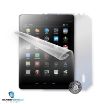 Obrázek ScreenShield fólie na celé tělo pro UMAX Vision Book 8Q