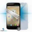 Obrázek ScreenShield fólie na celé tělo pro Prestigio MultiPhone PAP 5503 DUO