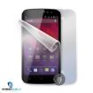 Obrázek ScreenShield fólie na celé tělo pro Sencor Element P501
