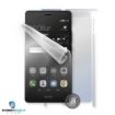 Obrázek ScreenShield fólie na celé tělo pro Huawei P9 Lite