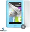 Obrázek ScreenShield fólie na celé tělo pro Billow Ebook E2TLB