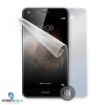 Obrázek ScreenShield fólie na celé tělo pro Huawei Y6 II Compact