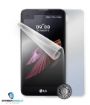Obrázek Screenshield fólie na celé tělo pro LG K500n X Screen