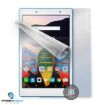 Obrázek Screenshield fólie na celé tělo pro LENOVO TAB3 8