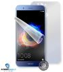 Obrázek ScreenShield fólie na celé tělo pro HUAWEI Honor 8 Pro