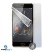 Obrázek ScreenShield fólie na celé tělo pro NUBIA M2 Lite NX573J