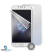 Obrázek Screenshield fólie na celé tělo pro DOOGEE X9 Pro