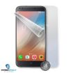 Obrázek Screenshield fólie na celé tělo pro DOOGEE X30