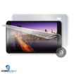 Obrázek ScreenShield fólie na celé tělo pro IGET Smart G81