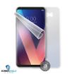 Obrázek ScreenShield fólie na celé tělo pro LG H930 V30