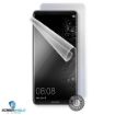 Obrázek ScreenShield fólie na celé tělo pro HUAWEI Mate 10 Pro