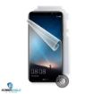 Obrázek ScreenShield fólie na celé tělo pro HUAWEI Mate 10 Lite