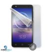 Obrázek ScreenShield fólie na celé tělo pro ALCATEL 5047U U5 HD Premium