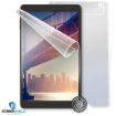 Obrázek ScreenShield fólie na celé tělo pro IGET Smart G102