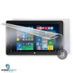Obrázek ScreenShield fólie na celé tělo pro TREKSTOR Surftab twin 11.6