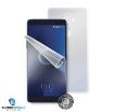 Obrázek Screenshield fólie na celé tělo pro ALCATEL 5099D 3V