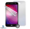 Obrázek Screenshield fólie na celé tělo pro LG M320N X Power 2