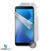 Obrázek Screenshield fólie na celé tělo pro ASUS Zenfone Max Plus ZB570TL