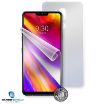 Obrázek Screenshield fólie na celé tělo pro LG LM-G710