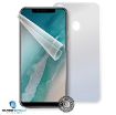 Obrázek Screenshield fólie na celé tělo pro ULEFONE X