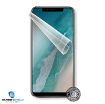 Obrázek Screenshield fólie na displej pro ULEFONE X