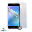 Obrázek Screenshield fólie na celé tělo pro MEIZU M6 Note