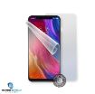 Obrázek Screenshield fólie na celé tělo pro XIAOMI Mi8