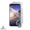 Obrázek ScreenShield fólie na celé tělo pro XIAOMI Mi Max 3
