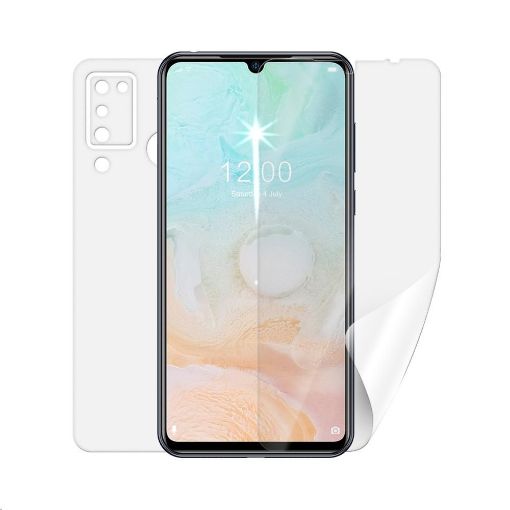 Obrázek Screenshield fólie na celé tělo pro DOOGEE N20 Pro