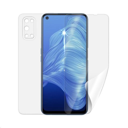 Obrázek Screenshield fólie na celé tělo pro REALME 7 5G