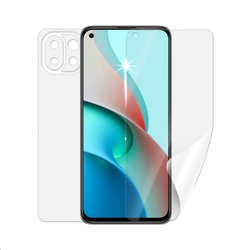 Obrázek Screenshield fólie na celé tělo pro XIAOMI Mi 11 Lite